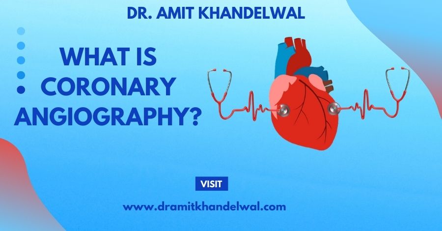 Coronary Angiography, What is Coronary Angiography, Coronary Angiography Preparation